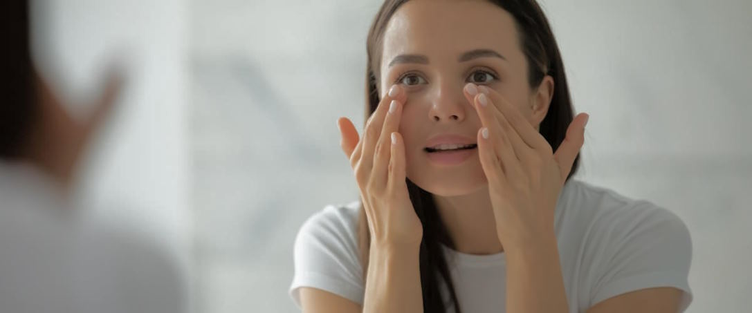 under-eye shadows